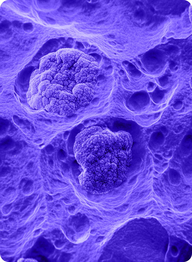 Exosomen Therapie Foto